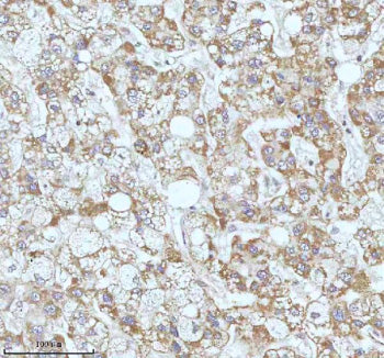 Immunohistochemical staining of GAREM1 using anti-GAREM1 antibody. GAREM1 was detected in a paraffin
