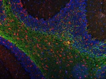 Immunofluorescent staining of FFPE rat cerebellum tissue with Siglec-4a antibody (green), GFAP antib