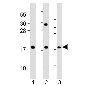 Western blot testing of human 1) HeLa, 2) THP1 and 3) RPMI 8226 cell lysate with GPX7 antibody at 1: