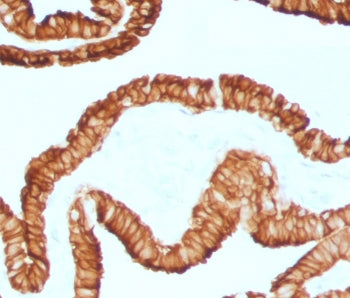 IHC staining of FFPE human oviduct with recombinant Cytokeratin 7 antibody (clone CTKN7-2R). Require