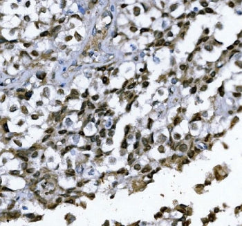 IHC staining of FFPE human tesis tissue with GATA1 antibody. HIER: boil tissue sections in pH8 EDTA 