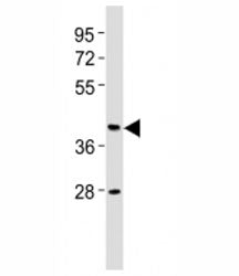 CB2 Antibody (Cannabinoid Receptor 2)