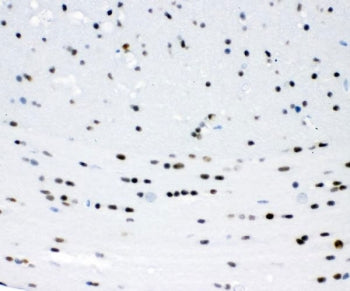 IHC staining of FFPE mouse brain tissue with SIP1 antibody. HIER: boil tissue sections in pH6 citrat