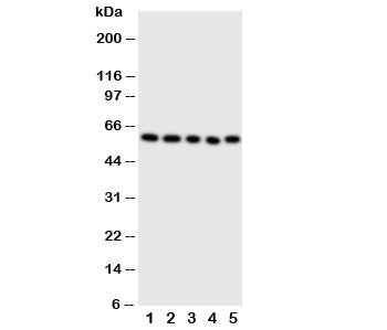 Western blot testing of ERp57 antibody and Lane 1: SMMC-7721; 2: A549; 3: U87; 4: HeLa; 5: MCF-7 cel