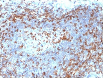 IHC testing of FFPE human lymph node with ZAP70 antibody (clone ZAP70/2046). HIER: boil tissue secti