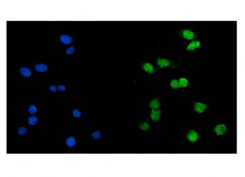 Immunofluorescent staining of FFPE human Caco-2 cells with Histone acetyltransferase 1 antibody (gre