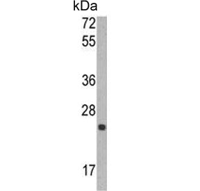 Western blot testing of human CCRF-CEM cell lysate with TIMP1 antibody. Predicted molecular weight ~