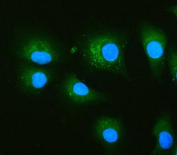 PRKCSH Antibody / Glucosidase 2 subunit beta