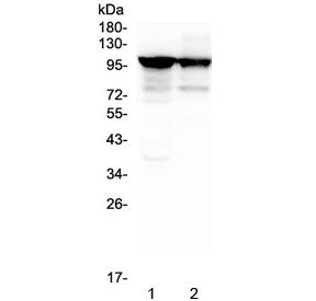 Western blot tesing of 1) rat skeletal muscle and 2) mouse skeletal muscle lysate with ACTN3 antibod