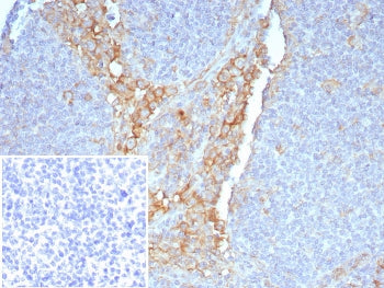 IHC staining of FFPE human tonsil tissue with FCGR1A antibody (clone FCGR1A/7497) at 2ug/ml. Inset: 