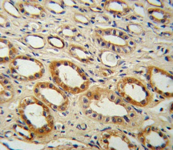 IHC testing of FFPE human kidney tissue with CYP27B1 antibody. HIER: steam section in pH6 citrate bu