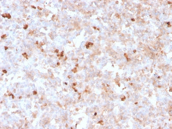 IHC staining of FFPE human spleen with recombinant Lambda Light Chain antibody (clone rLLC/1738). HI