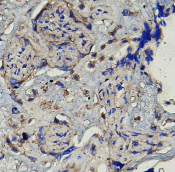 MMP16 Antibody