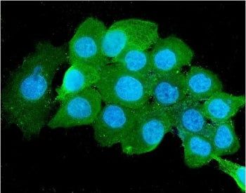 Immunofluorescent staining of FFPE human A431 cells with B2M antibody (green) and DAPI nuclear stain