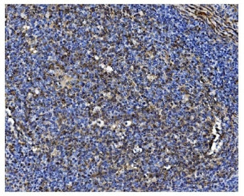 IHC staining of FFPE human tonsil with PCBP1 antibody. HIER: boil tissue sections in pH8 EDTA for 20