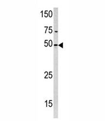 Western blot analysis of PXK antibody and HeLa lysate. Expected molecular weight: 51-65 kDa (three i