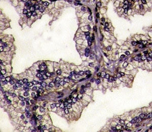 Lactoferrin Antibody (LTF)