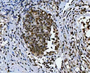 TRIR Antibody / Telomerase RNA component interacting RNase
