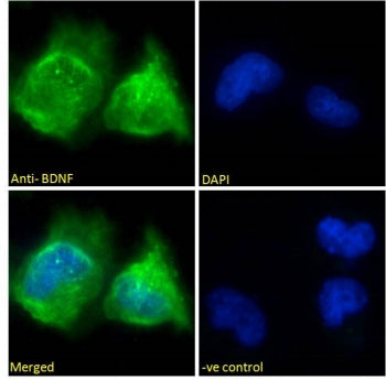 Immunofluorescent staining of fixed and permeabilized human U-251 cells with BDNF antibody (green) a