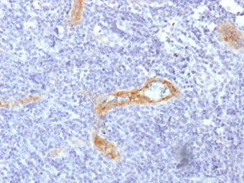 IHC testing of FFPE human tonsil with recombinant von Willebrand Factor antibody (clone rVWF/1465). 