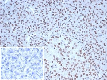 IHC staining of FFPE human pancreatic tissue with Nucleolin antibody (clone NCL/7338). HIER: boil tissue sections in pH 9 10mM Tris with 1mM EDTA for 20 min and allow to cool before testing.