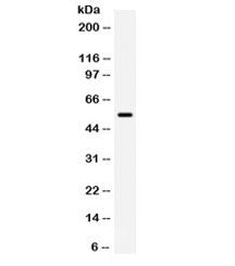 BMPR1B Antibody