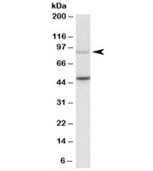 Western blot testing of Jurkat lysate with WHIP antibody at 1ug/ml. Predicted molecular weight: ~72/