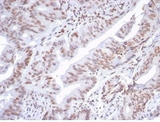 IHC staining of FFPE human colon tissue with ATRX antibody (clone ATRX/7188R). HIER: boil tissue sec