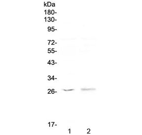 Western blot testing of human 1) MCF7 and 2) COLO320 antibody at 0.5ug/ml. Predicted molecular weigh