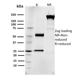 SDS-PAGE analysis of purified, BSA-free EGFR antibody (clone R1) as confirmation of integrity and pu
