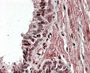 IHC testing of FFPE human prostate with ZNF217 antibody at 4ug/ml. HIER: steamed with pH6 citrate bu