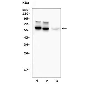 Western blot testing of 1) rat brain, 2) mouse brain and 3) human U-87 MG cell lysate with Tyrosine 