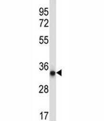 AMPK beta 2 Antibody / PRKAB2, 0.08ml