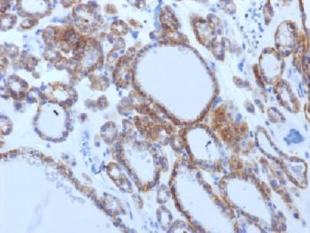 Thyroid Stimulating Hormone Receptor / TSHR Antibody (beta chain)