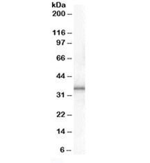 Western blot testing of human adipose lysate with UCP1 antibody at 1ug/ml. Predicted molecular weigh