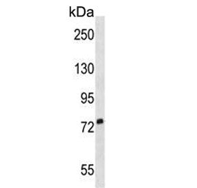 Western blot testing of human T-47D cell lysate with SIGLEC5 antibody. Expected molecular weight: 60