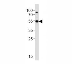 Western blot analysis of lysate from Jurkat cell line using AKT3 antibody at 1:1000. Predicted molec
