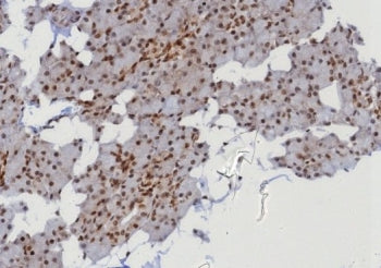 IHC staining of FFPE human parotid gland with MGMT antibody (clone MGMT/8128R). HIER: boil tissue se