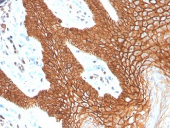 E-Cadherin Antibody / CDH1