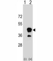 Western blot analysis of CD1b antibody and 293 cell lysate (2 ug/lane) either nontransfected (Lane 1