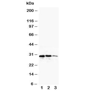 Western blot testing of CUEDC2 antibody and recombinant protein, 29KD with tag; Lane 1: 10ng; 2: 5ng