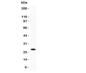 Western blot testing of Prolactin antibody and MCF7 lysate. Predicted/observed molecular weight: ~25