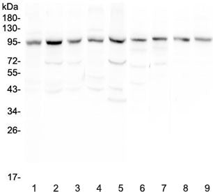 Western blot testing of human 1) HeLa, 2) placenta, 3) HepG2, 4) SGC-7901, 5) 22RV1, 6) rat lung, 7)