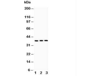 Western blot testing of IL3 antibody and Lane 1: PC-12; 2: NRK; 3: RH35; The glycoprotein is routine