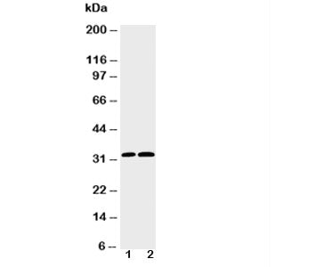 Western blot testing of Caspase-3 antibody and Lane 1: HeLa; 2: SMMC-7721 cell lysate