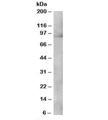 Western blot testing of A431 lysate with XAB2 antibody at 0.3ug/ml. Predicted molecular weight: ~100