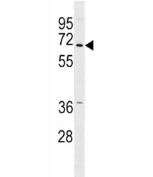 PINK1 Antibody (PARK6)