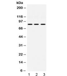 KRIT1 Antibody