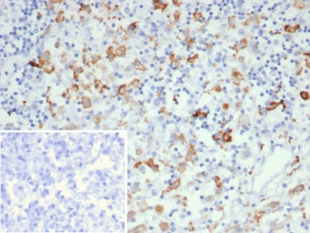 IHC staining of FFPE human lymph node tissue with CD163L1 antibody (clone CD163L1/7971). Inset: PBS 