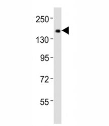 Tet1 Antibody